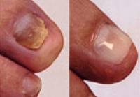 Vergelding Productie Ongewapend Cosmetische behandeling Gel / Acrylnagels - Formosus Pedicure Manicure